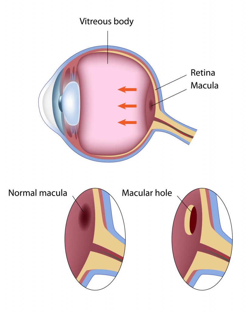 Macular Eye Chart